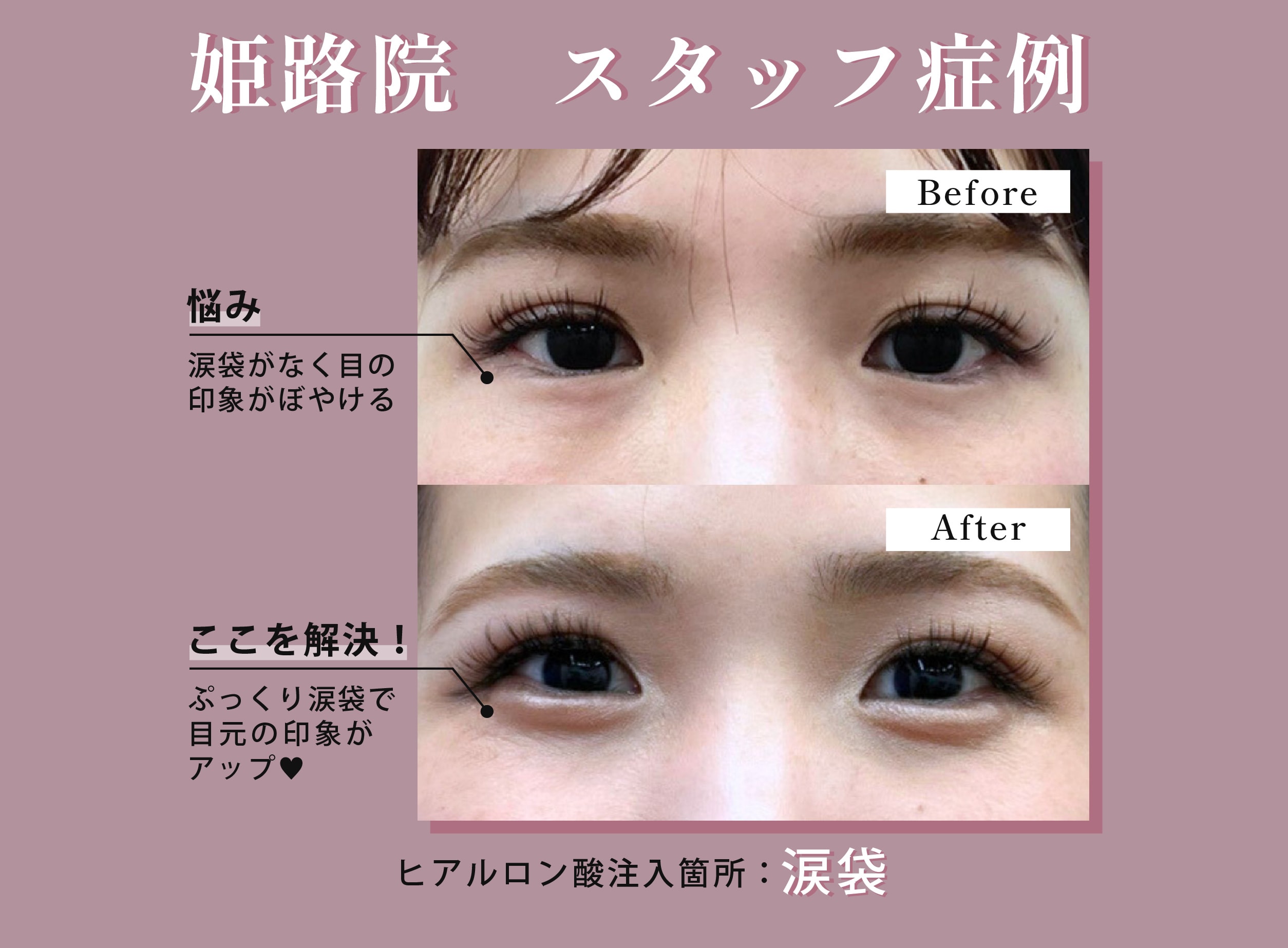 姫路院スタッフの驚きの変化がこちら✨