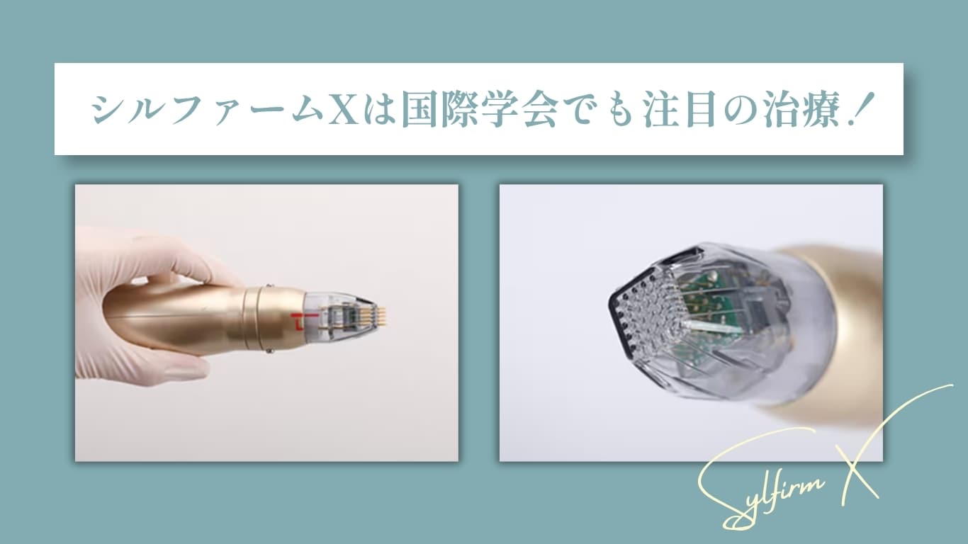 シルファームXはココがすごい！