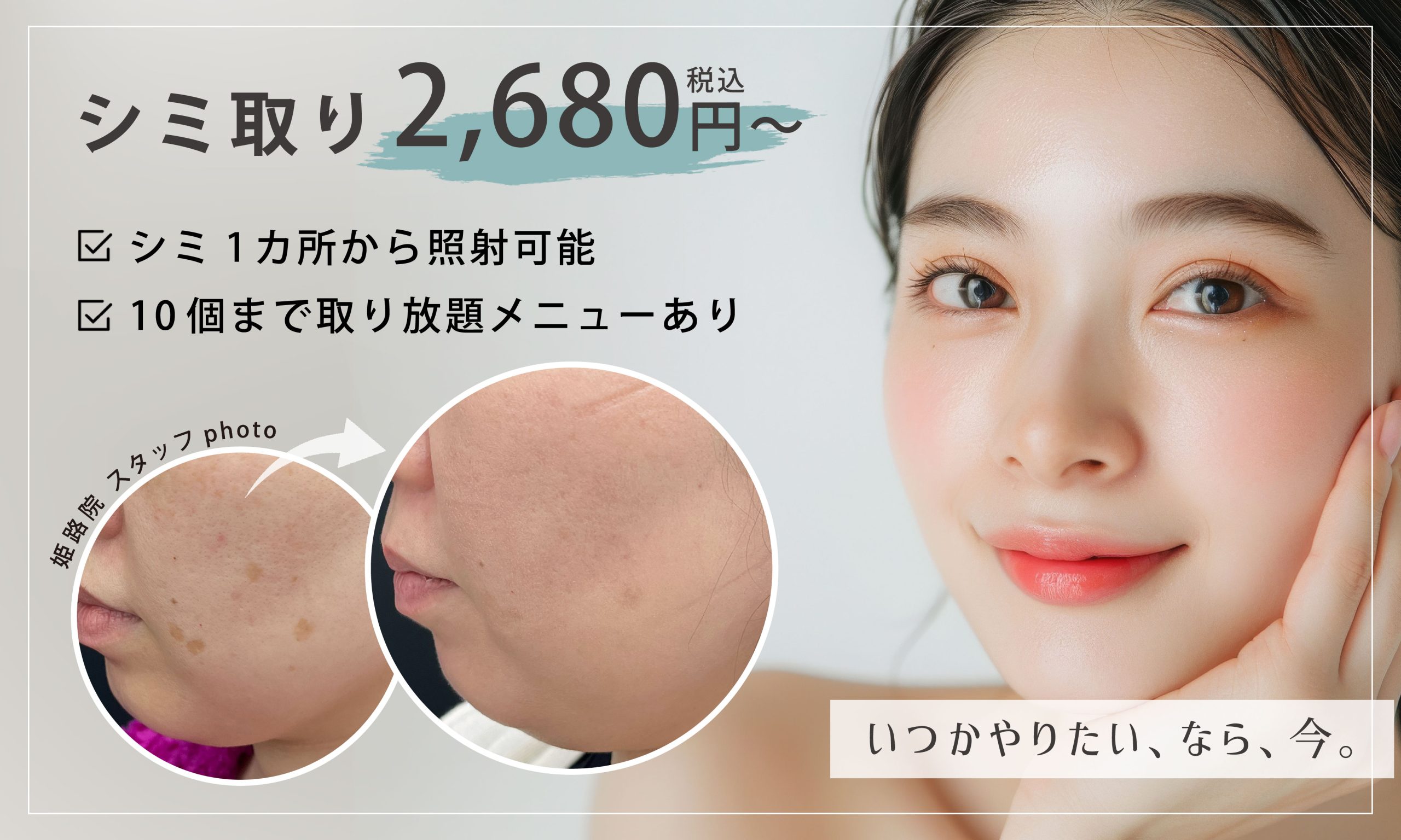 シミ取り2,680円〜！姫路でシミ取りするならSBC姫路院