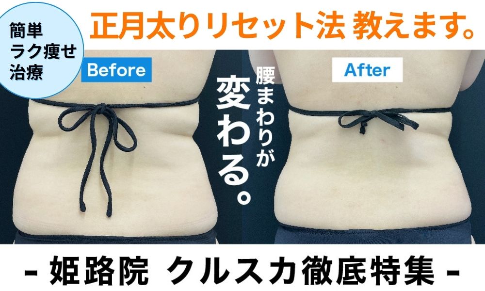 【姫路院クルスカ徹底特集】　正月太りには簡単ラク痩せクールスカルプティングエリート！気になる脂肪撃退の最新メソッド！