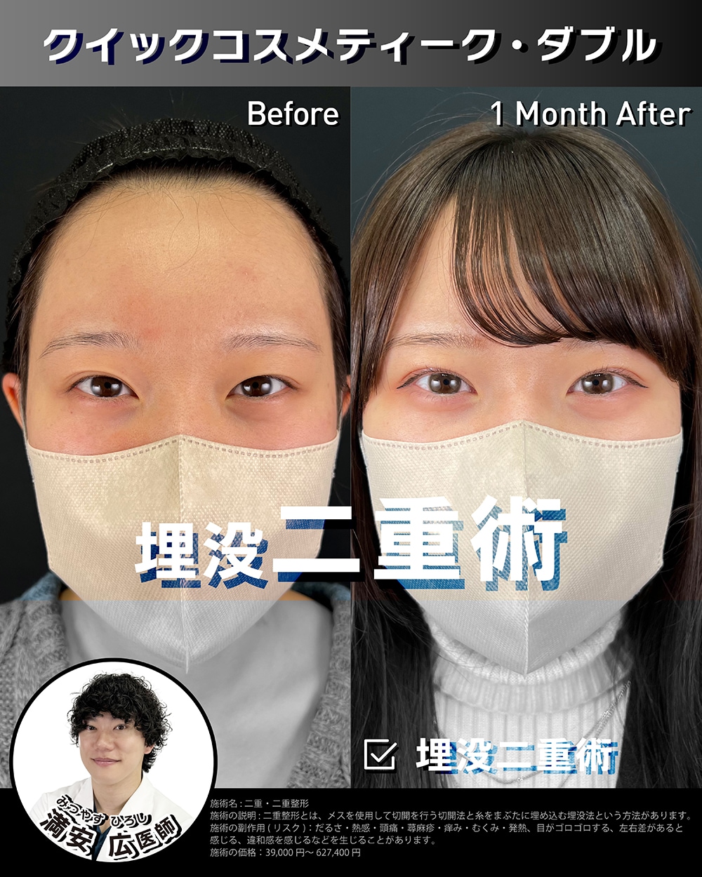 院長しか出来ない埋没法 クイックコスメティーク・ダブル Neo