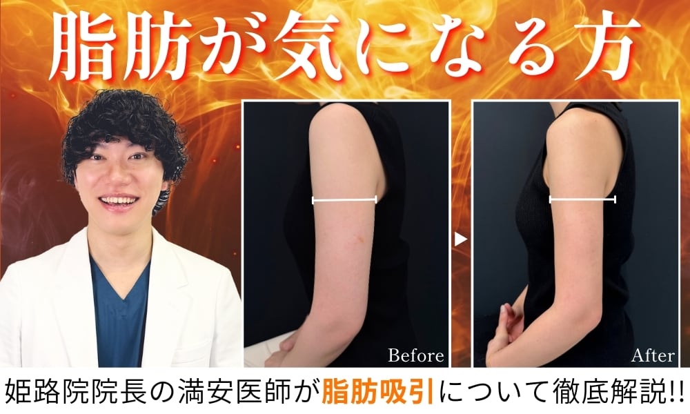関西、兵庫、姫路で脂肪吸引するなら姫路院！