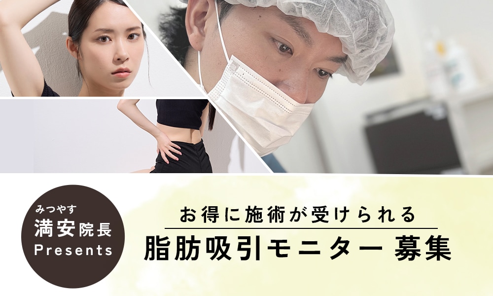 大人気脂肪吸引 モニター募集中♥