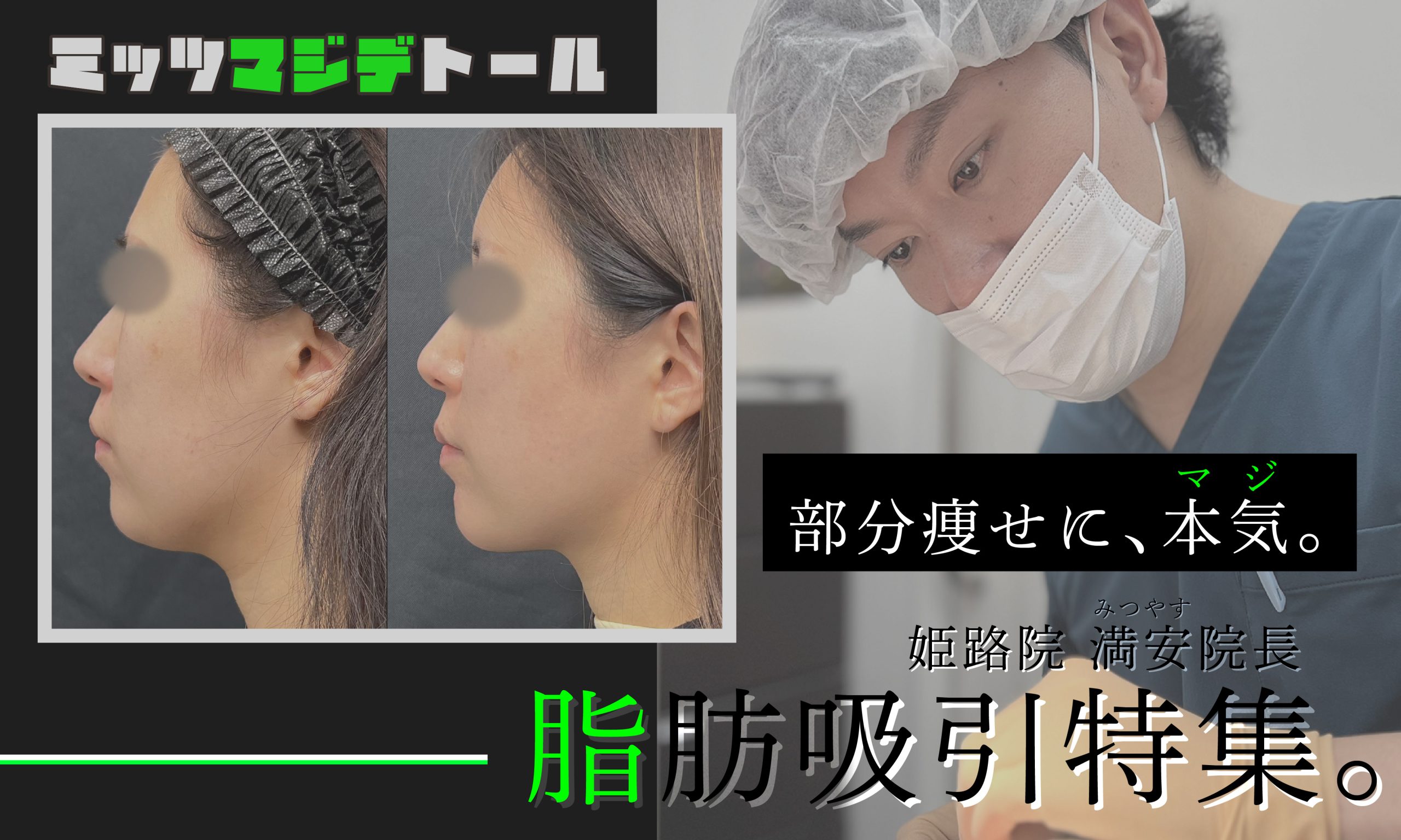 関西、兵庫、姫路で脂肪吸引するなら姫路院！
