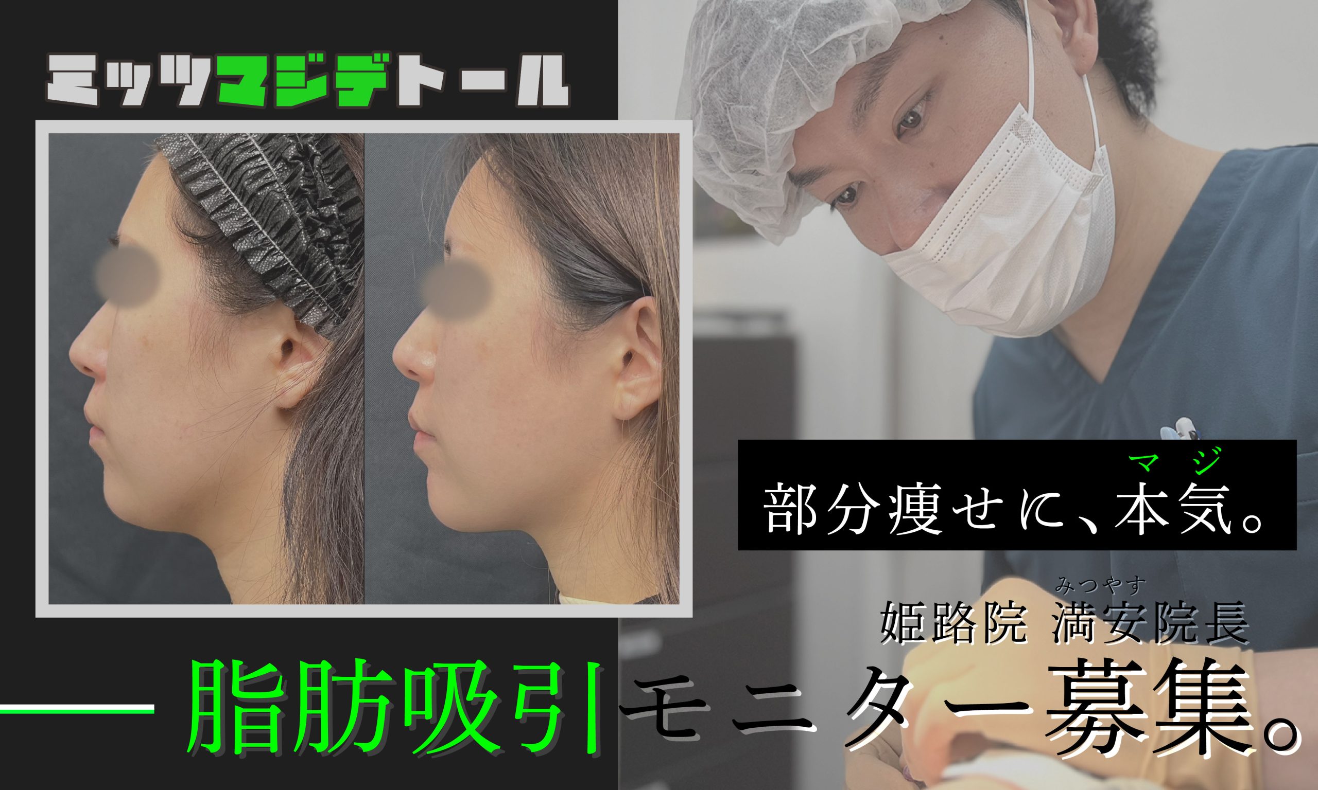 新院長就任💚大人気モニター募集開始！