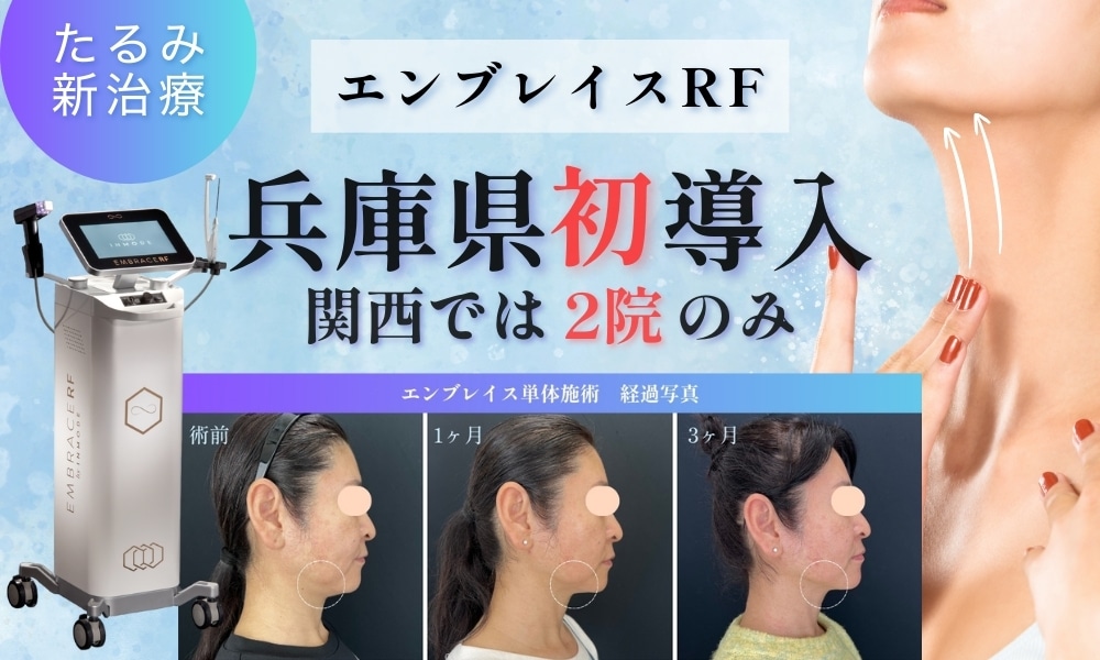 【兵庫県初導入】話題のたるみ新治療「エンブレイス」 引き締まったフェイスライン・ボディラインを目指すなら、湘南美容クリニック姫路院へ！