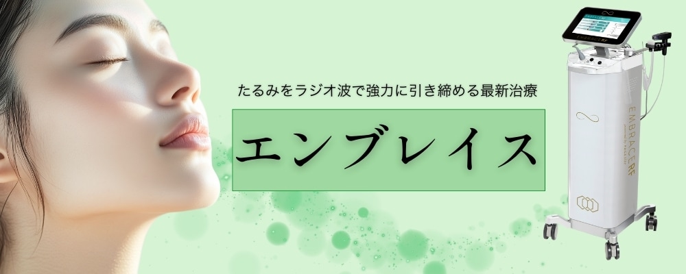 エンブレイスとは？