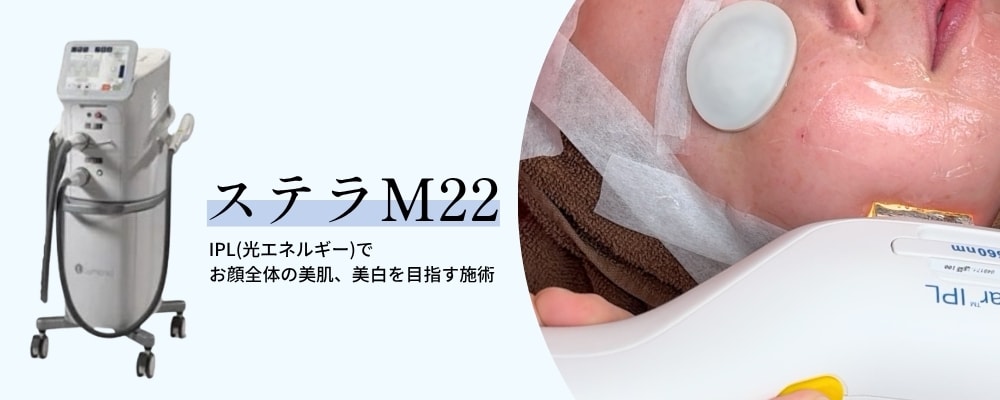 フォトダブル・トリプル・フォトジェネシスとは？