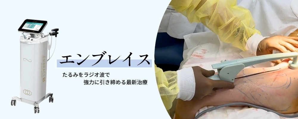 エンブレイスとは？