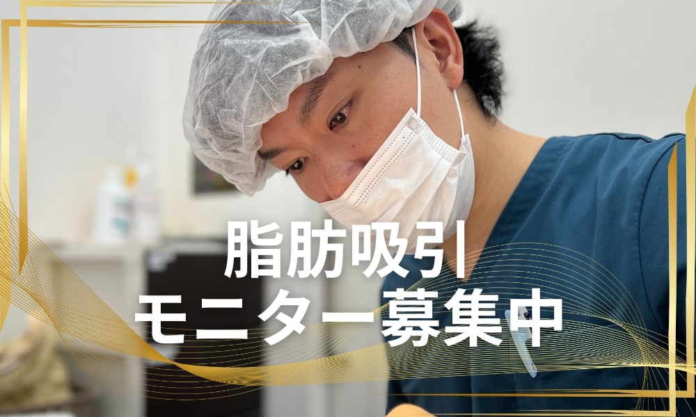 満安医師　脂肪吸引モニター募集中です！