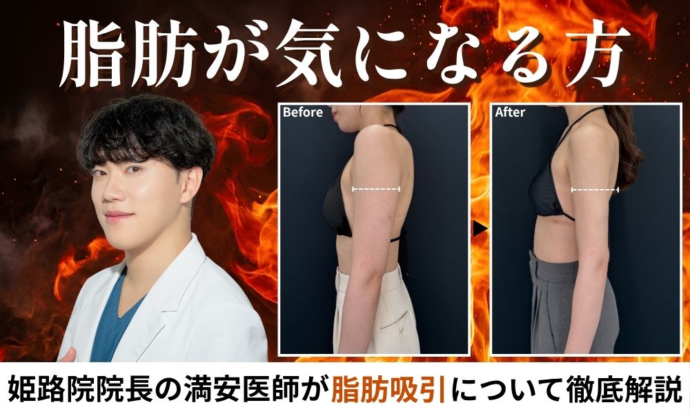 姫路で脂肪吸引なら湘南美容クリニック姫路院｜満安院長の圧倒的症例数と技術力