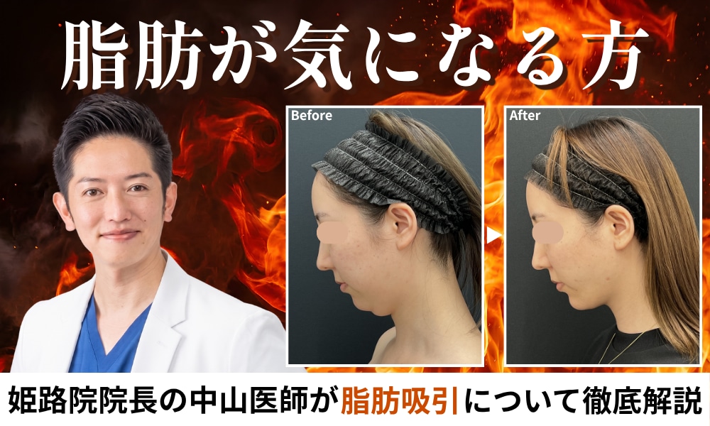 姫路で脂肪吸引なら湘南美容クリニック姫路院｜中山院長の圧倒的症例数と技術力