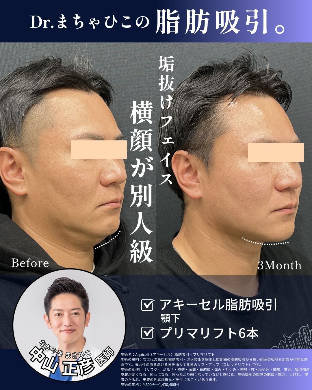 顔周りすっきり小顔に。