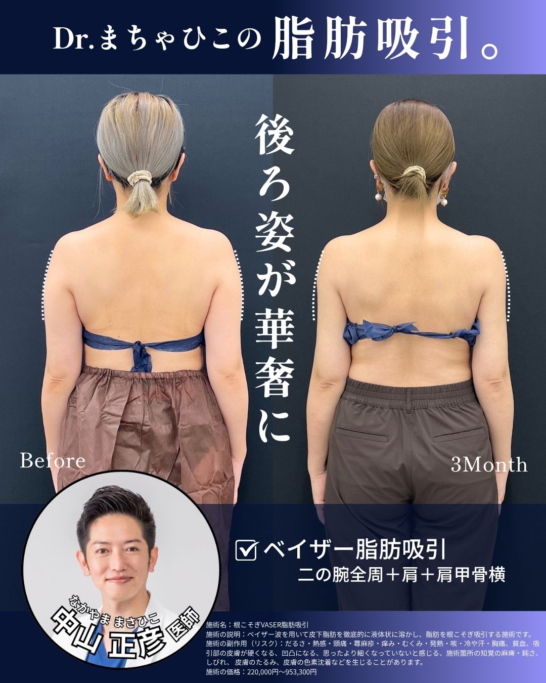 二の腕もアップデート