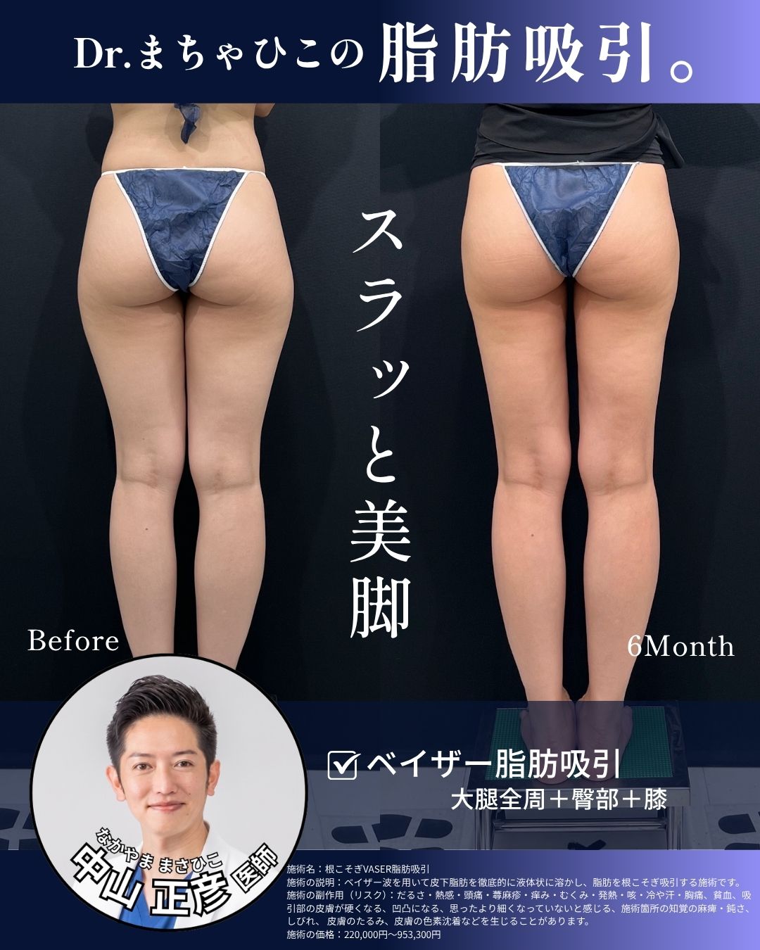 下半身も細く。