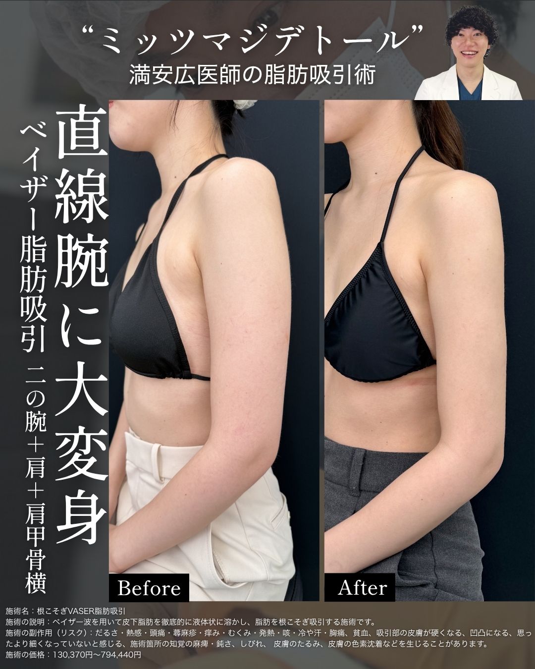 二の腕もアップデート