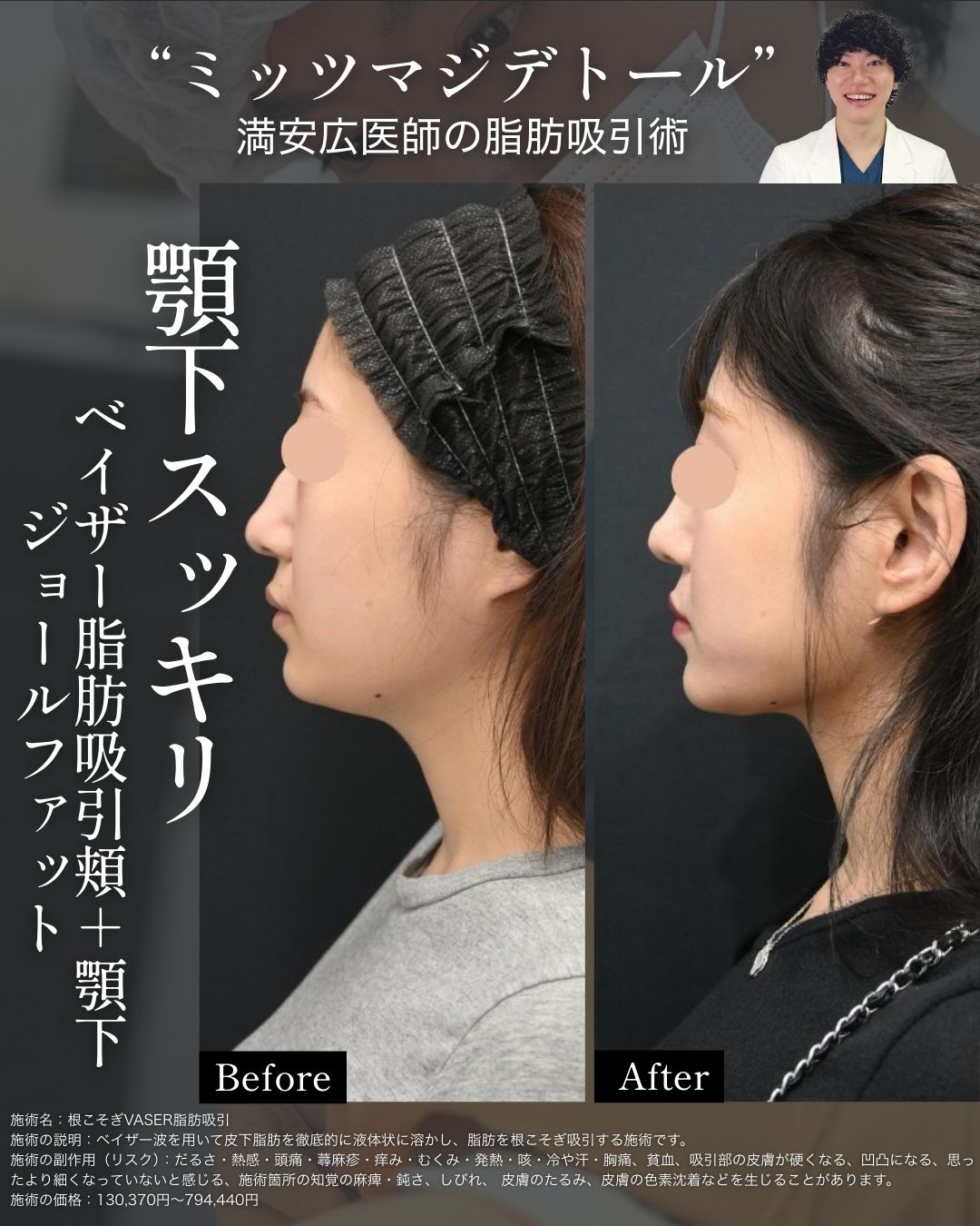 顔周りすっきり小顔に。