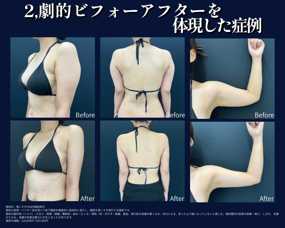 劇的ビフォーアフターを体現した症例