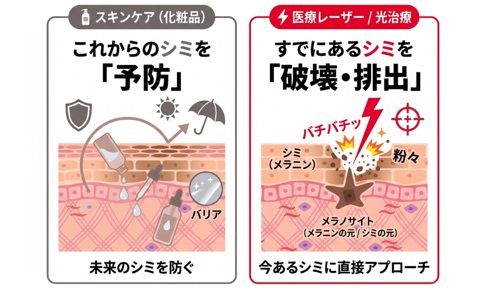 予防目的のスキンケアと破壊排出目的の医療レーザー・光治療の比較図｜SBC姫路院