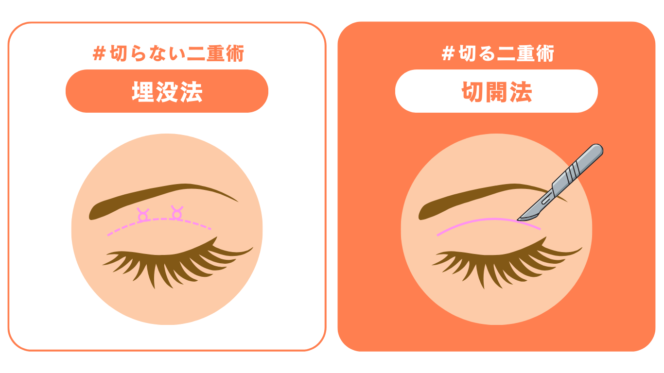 「切る」か「切らない」か