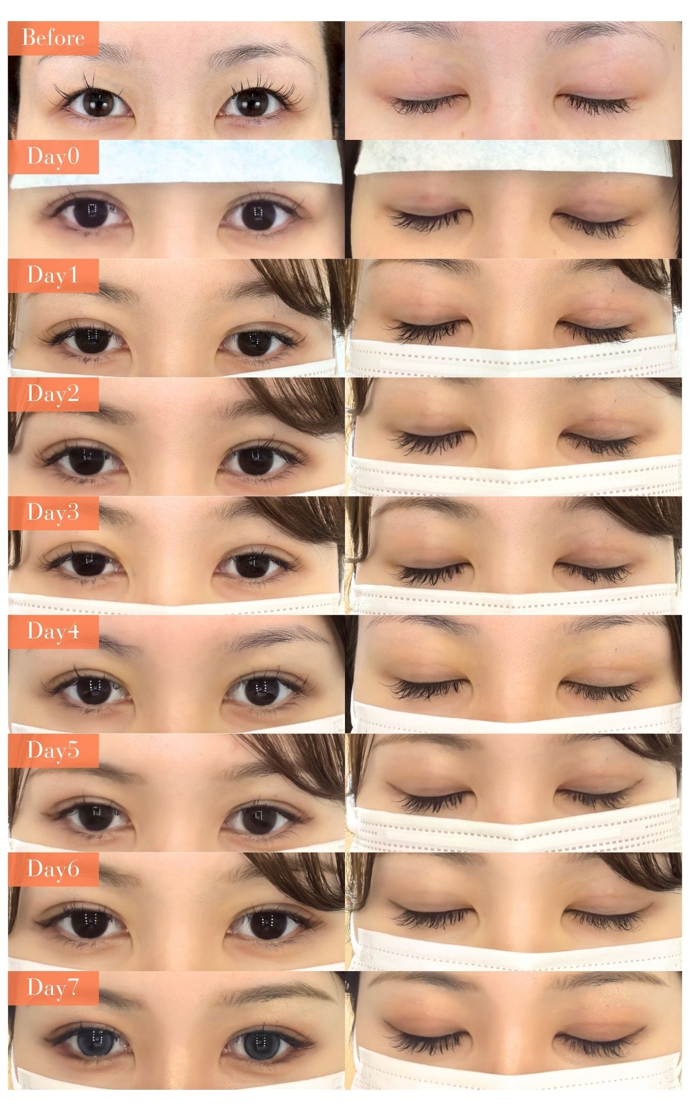 施術直後〜1週間目の様子