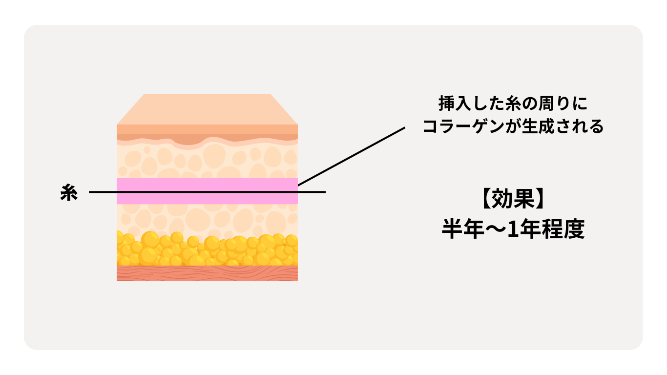 糸＋うるおいコラーゲンリフト