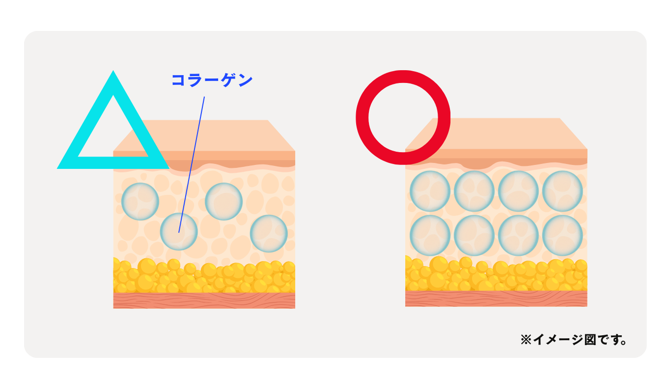 糸＋ジャルプロ
