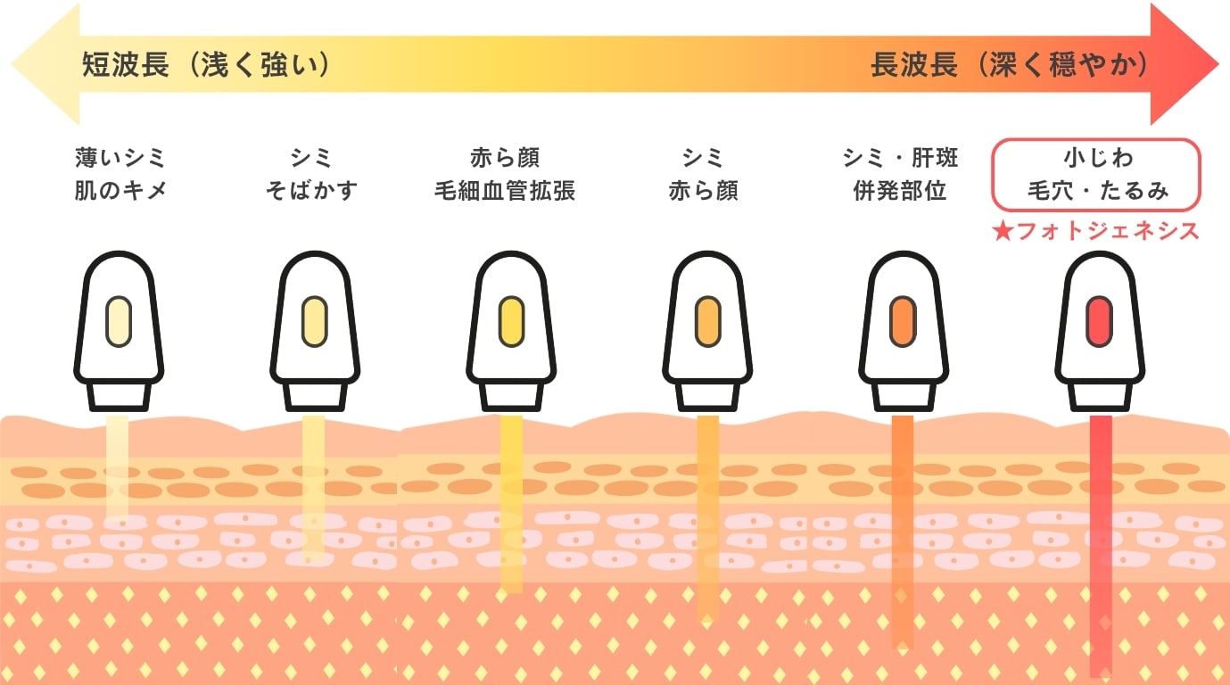 フォトジェネシスとは？
