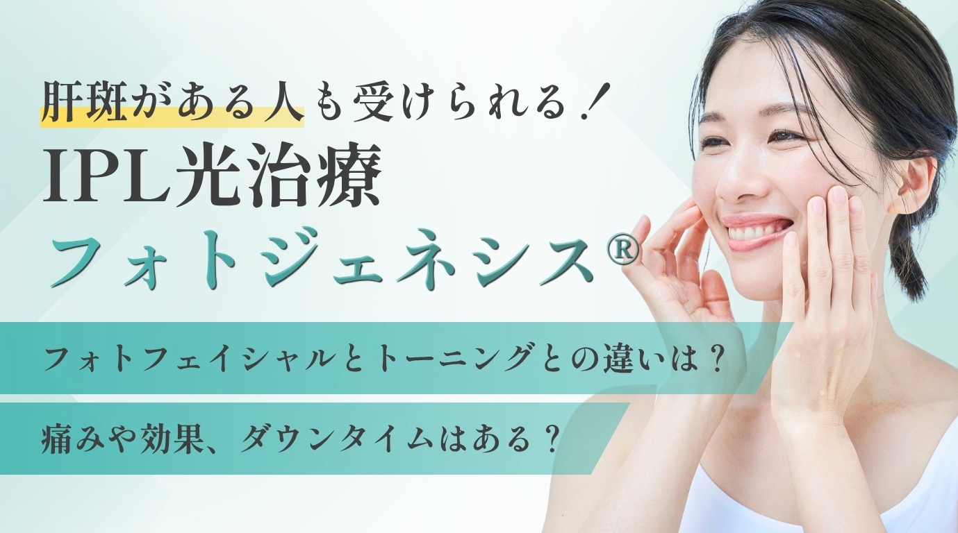 姫路・加古川】肝斑があっても諦めない！フォトジェネシス（ステラM22