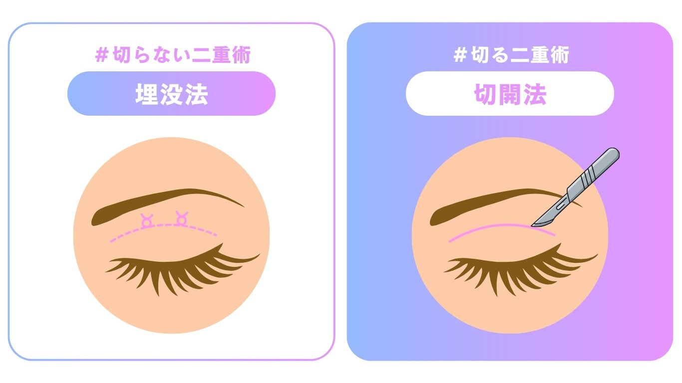 「切る」か「切らない」か