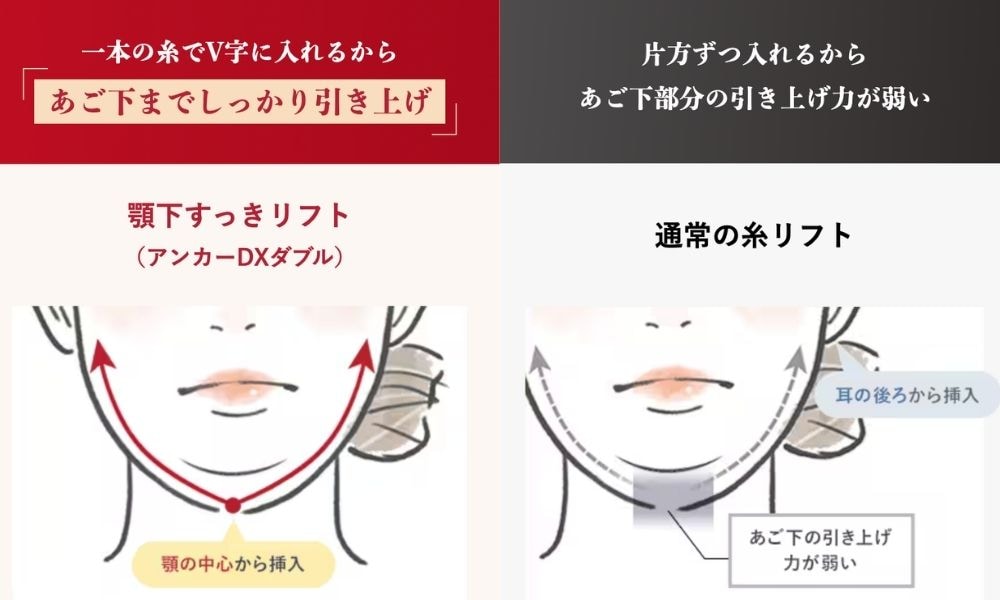 他の糸との違い