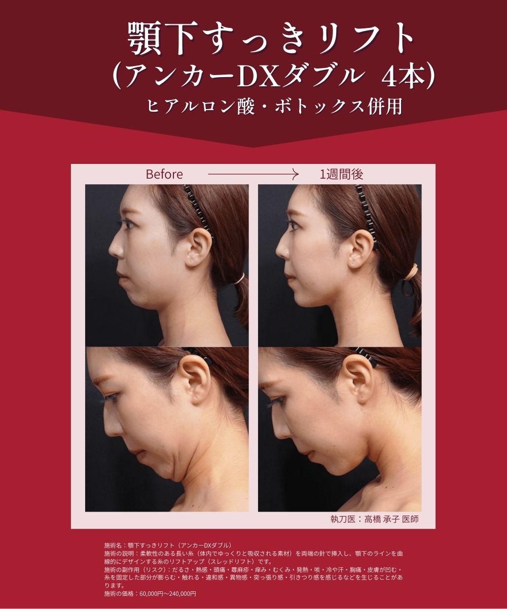 直後から二重顎改善✨