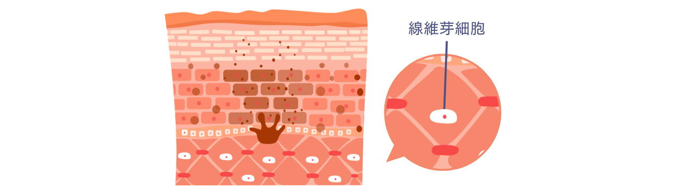 線維芽細胞の再生