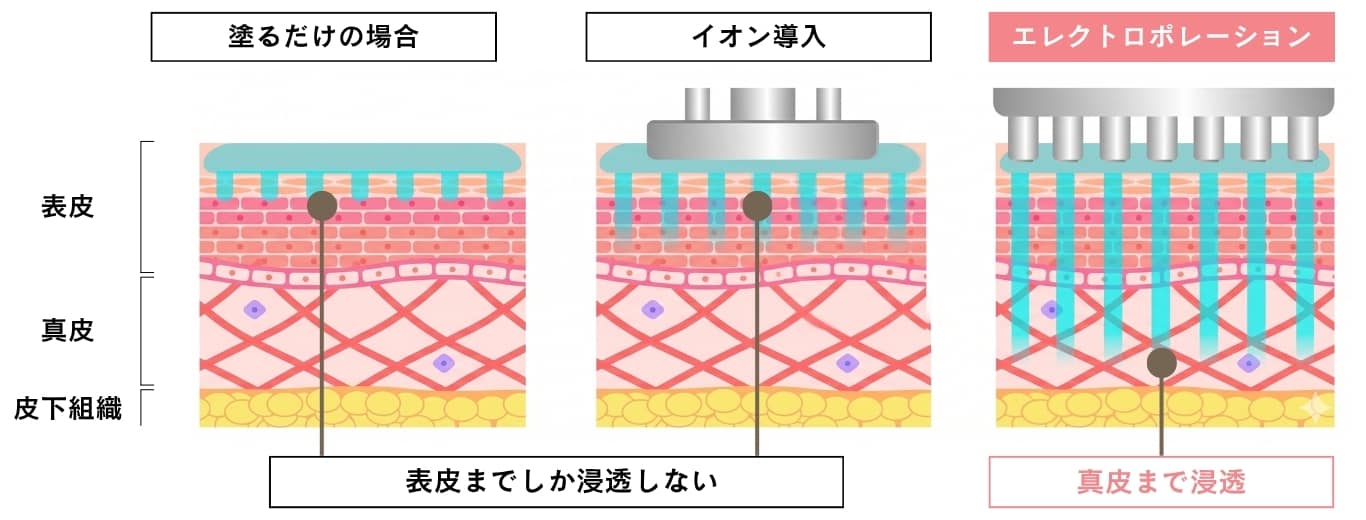 エレクトロポレーションの浸透深度