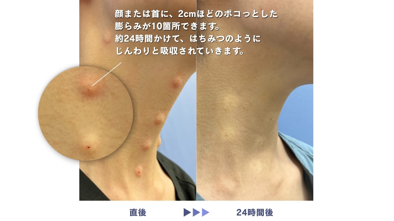 プロファイロのダウンタイム
