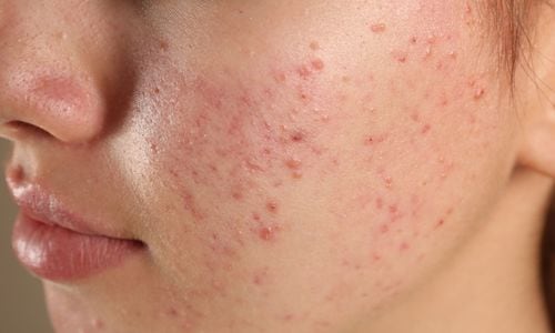 ひとりで鏡を見て落ち込み、諦めてしまっていませんか？