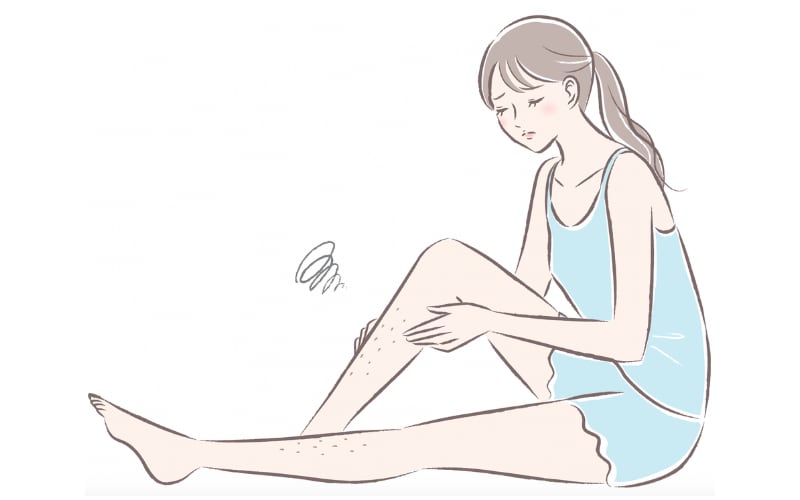 ②蒸れるVIO・脇のムダ毛に医療脱毛を！
