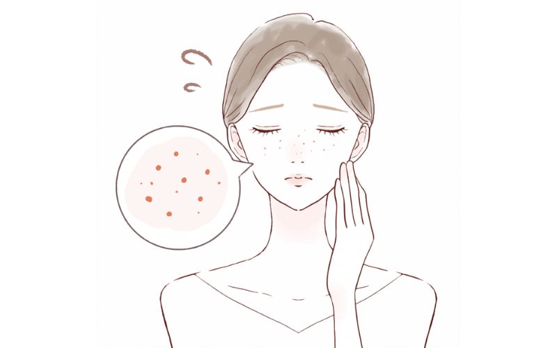 ③皮脂と汚れでざらつくお肌にピーリングを！
