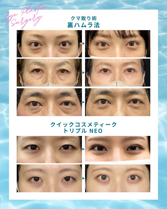 📷中山院長による目元施術 Before/After