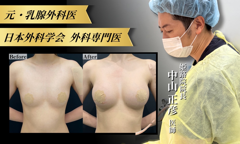 【バストを知り尽くした元乳腺外科医の豊胸】湘南美容クリニック姫路院 中山正彦(まちゃひこ)院長