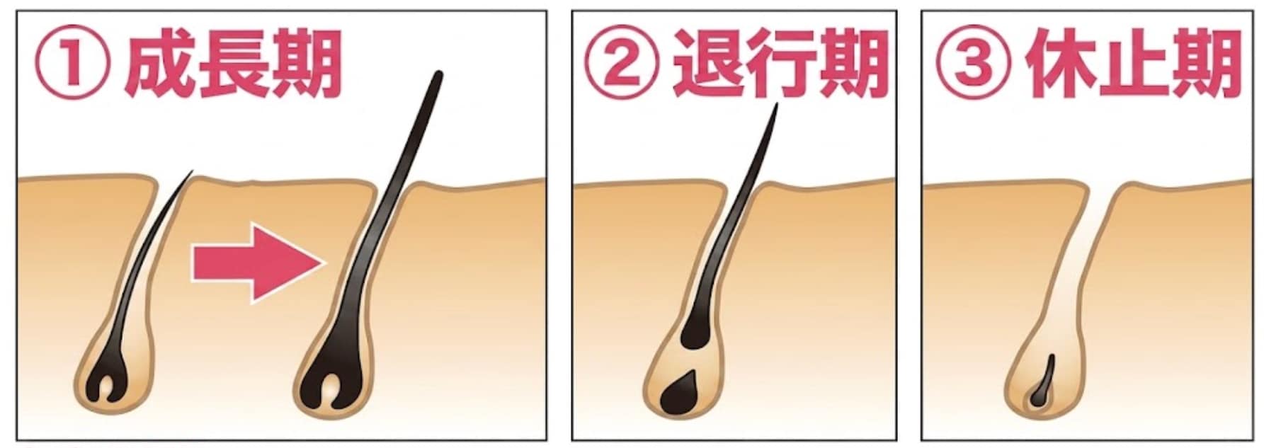 「毛周期」の「成長期」に合わせた照射が重要