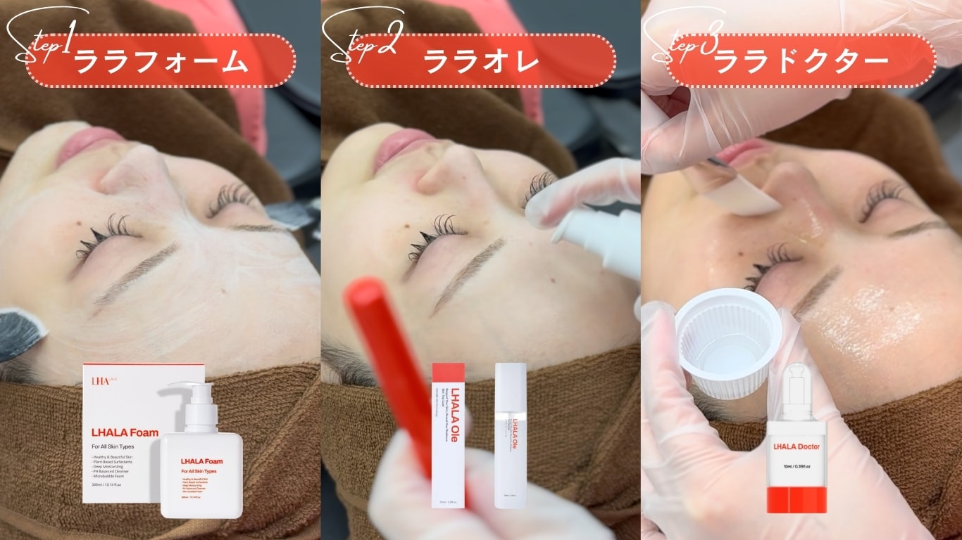 3STEPの施術方法