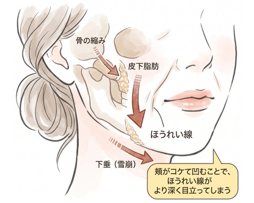 40代の老け顔の原因