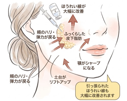 老け顔の解決策