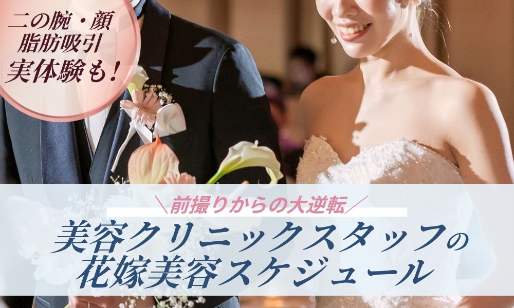 【卒花スタッフが解説】花嫁美容医療スケジュール!二の腕・顔脂肪吸引からボトックス・ヒアルロン酸まで絶対に失敗しない逆算ロードマップ