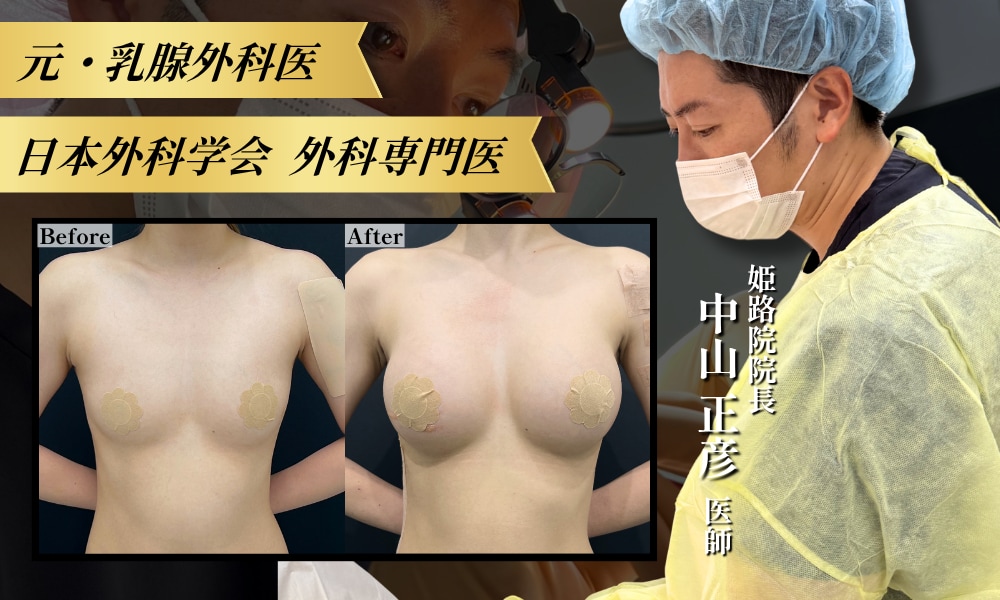 【姫路】元乳腺外科医が叶える理想の豊胸|SBC姫路院 中山正彦(まちゃひこ)院長【最大21万円OFF】