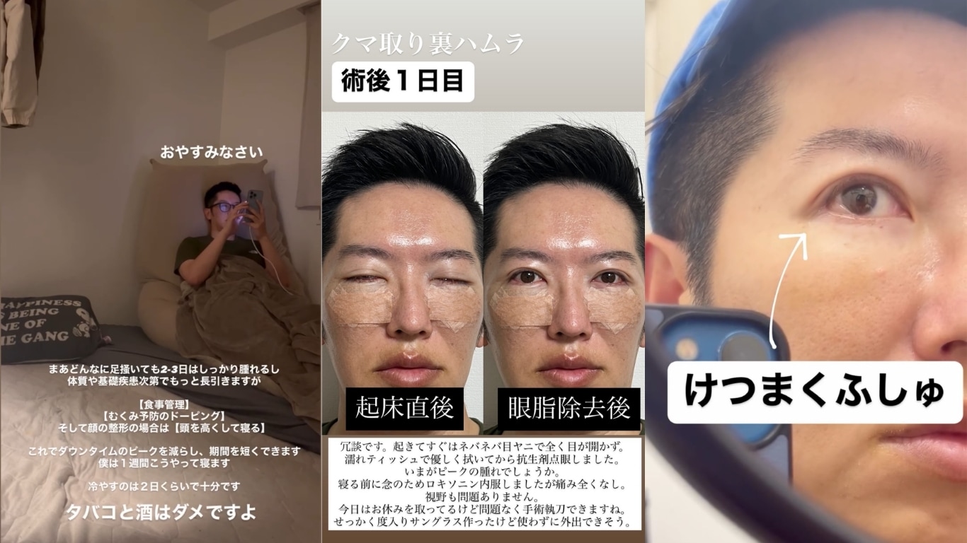 中山院長自身も<br />
裏ハムラ法を経験済み