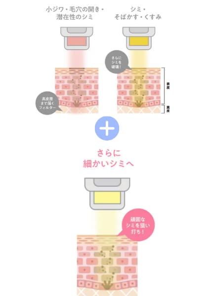 フォトトリプル 照射イメージ