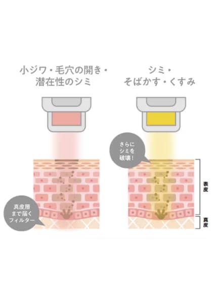 フォトダブル 照射イメージ
