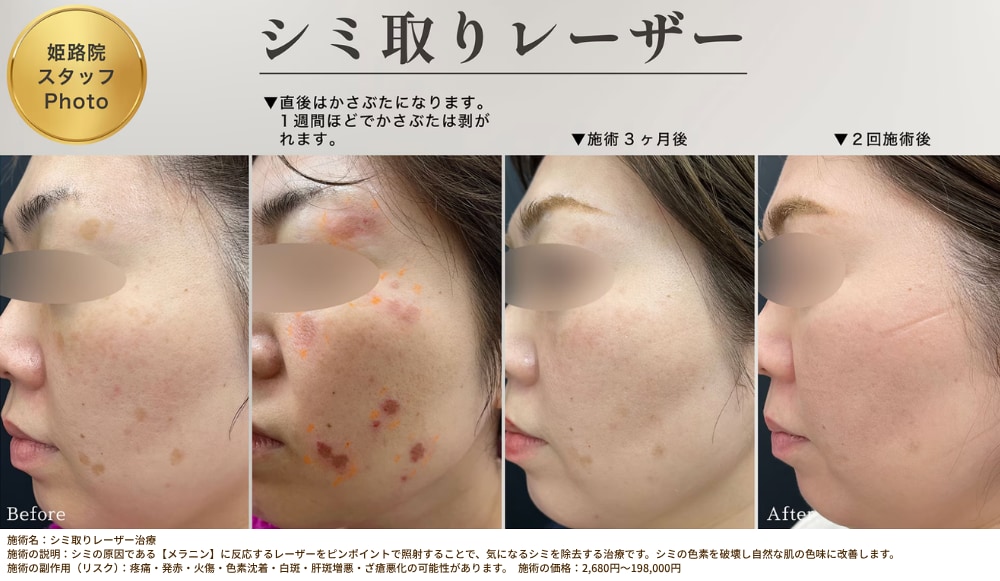 ここに代替テキストを入力
